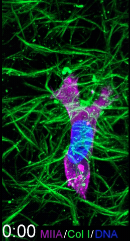 HT-1080 fibrosarcoma epithelial cell moving on the extracellular matrix.